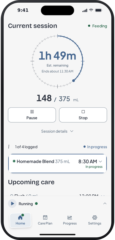 Tubular home screen with a feed running: time remaining, volume delivered, and today's timeline