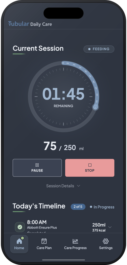 Tubular Daily Care showing a live feeding session with time remaining, volume progress, and today's timeline below